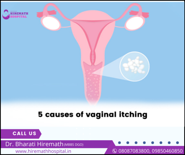 Top 5 causes of vaginal itching Gynecologist in PCMC