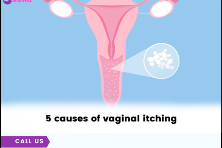 Top 5 causes of vaginal itching Gynecologist in PCMC