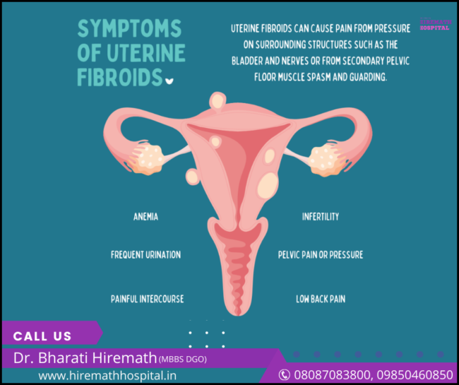 Fibroids: Recognizing Signs and Symptoms Uterine Fibroids Treatment in PCMC