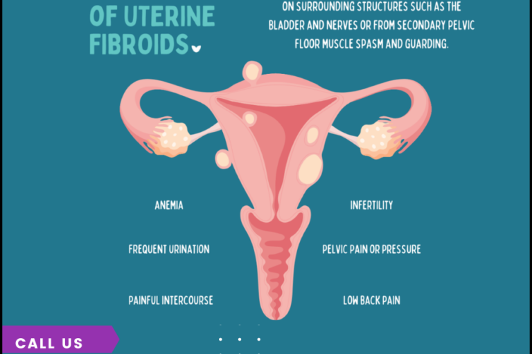 Fibroids: Recognizing Signs and Symptoms Uterine Fibroids Treatment in PCMC
