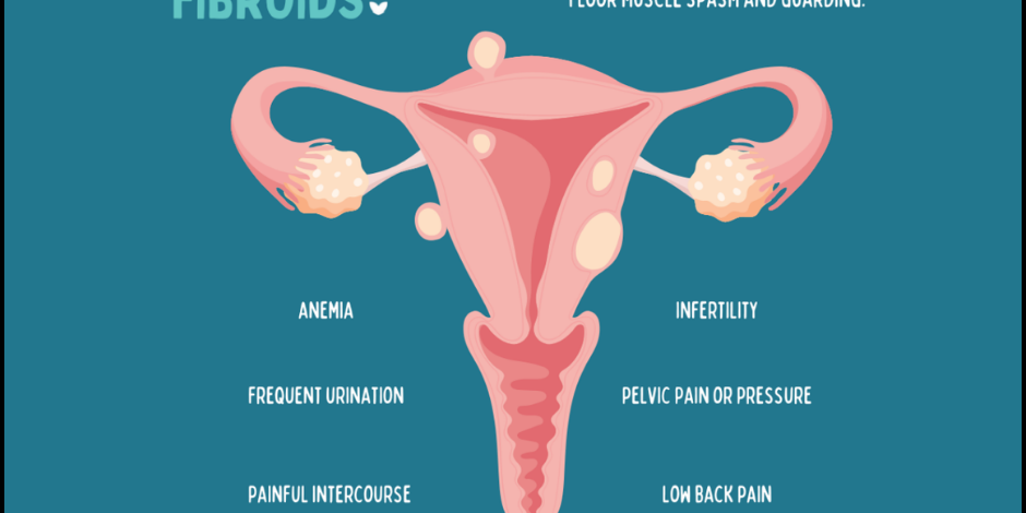 Fibroids: Recognizing Signs and Symptoms Uterine Fibroids Treatment in PCMC