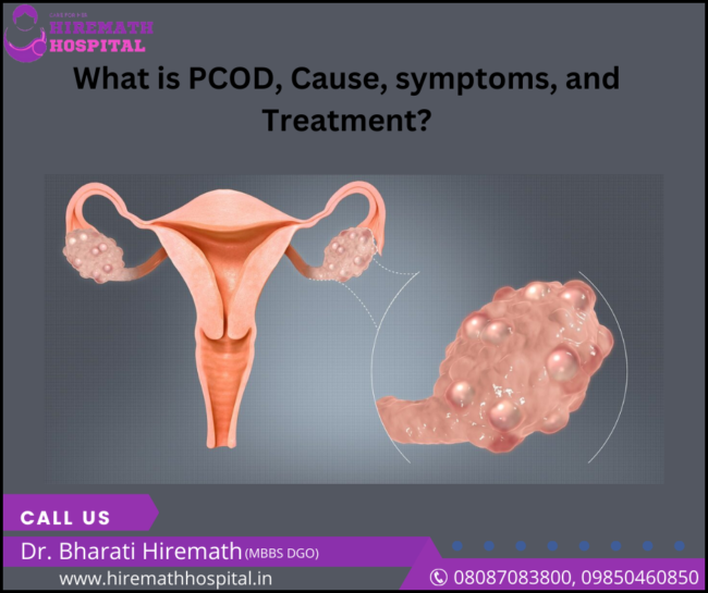 What is PCOD, Cause, symptoms, and Treatment? PCOS Treatment in PCMC