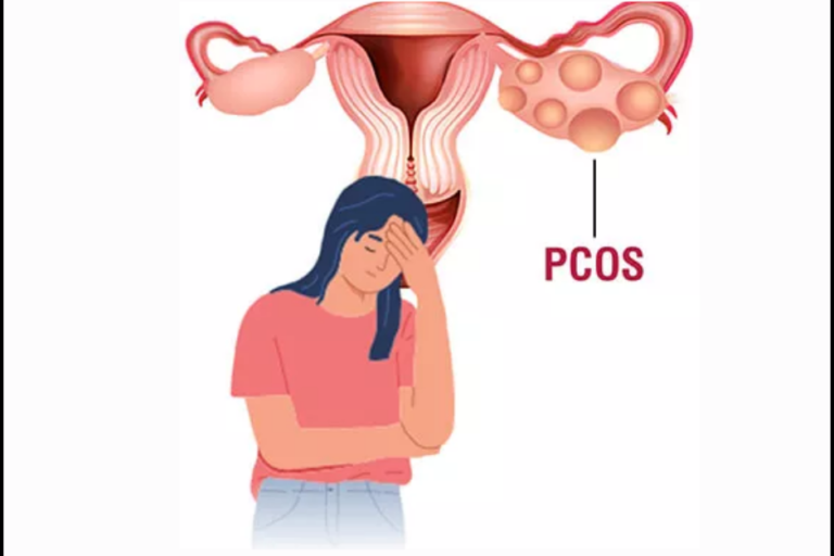 What is PCOS? | Hiremath Hospital | Dr. Bharati Hiremath PCOS Treatment in PCMC