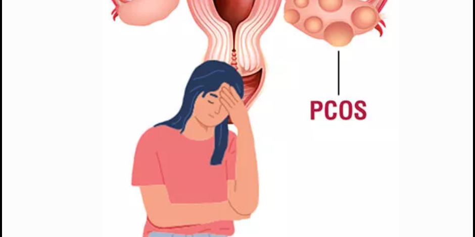 PCOS Treatment in PCMC