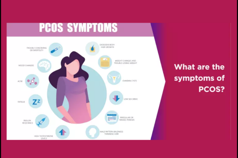 What are the symptoms of PCOS? PCOS Treatment in PCMC