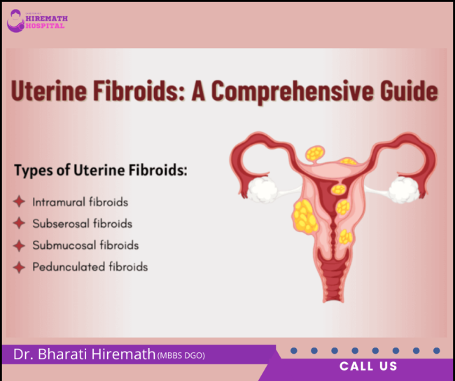 Uterine Fibroids: Causes, Symptoms, Types, and Treatment Uterine Fibroids Treatmenet in PCMC