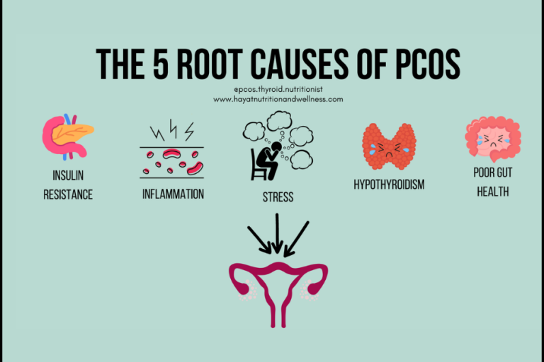 The 5 Root Causes of PCOS Root Causes of PCOS