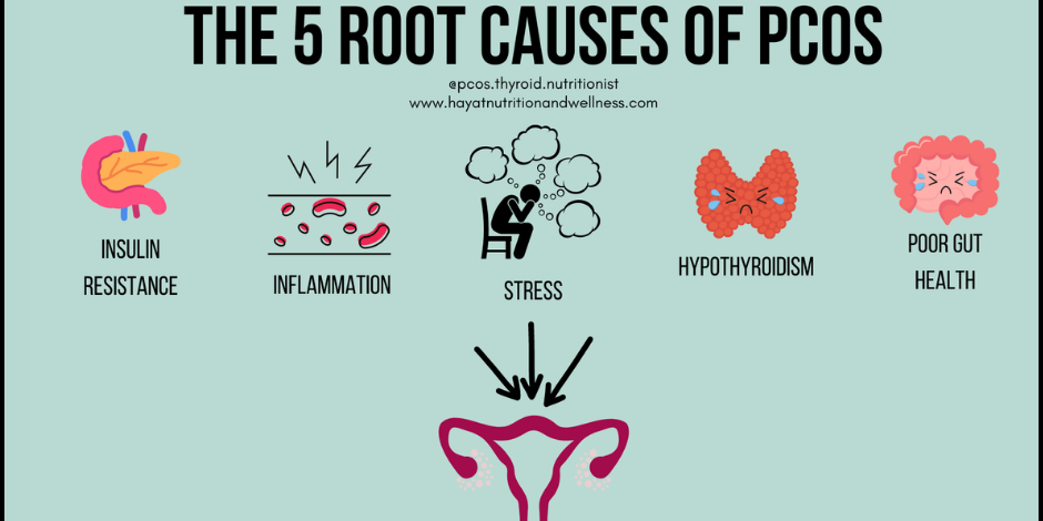 The 5 Root Causes of PCOS Root Causes of PCOS