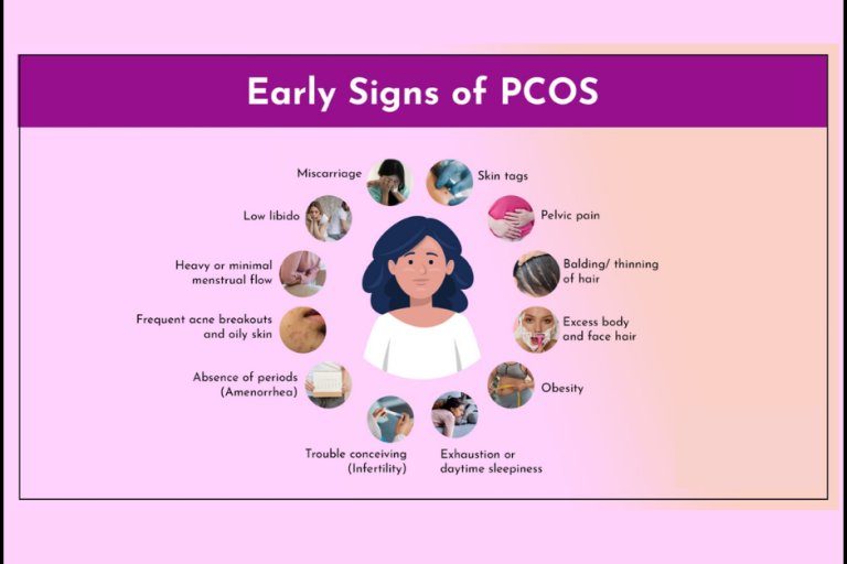 Understanding PCOS: Symptoms, Diagnosis, and Treatment with Dr. Bharati Hiremath at Hiremath Hospital PCOS Treatment in Pune