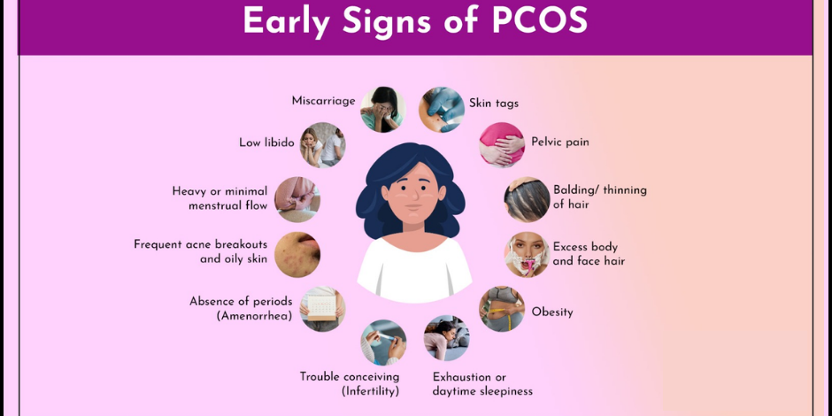 Understanding PCOS: Symptoms, Diagnosis, and Treatment with Dr. Bharati Hiremath at Hiremath Hospital PCOS Treatment in Pune