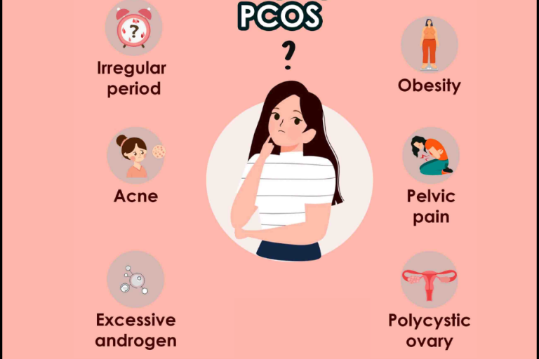 Common Symptoms of PCOS: Understanding the Signs PCOS treatmenet in pune