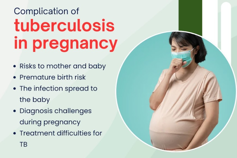 Complications of Tuberculosis in Pregnancy: Tuberculosis in Pregnancy
