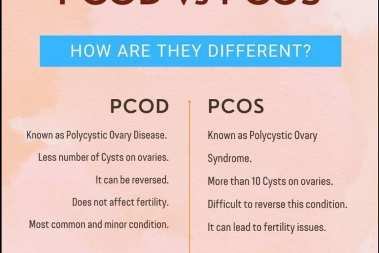 PCOD vs. PCOS: Understanding the Differences PCOD vs. PCOS