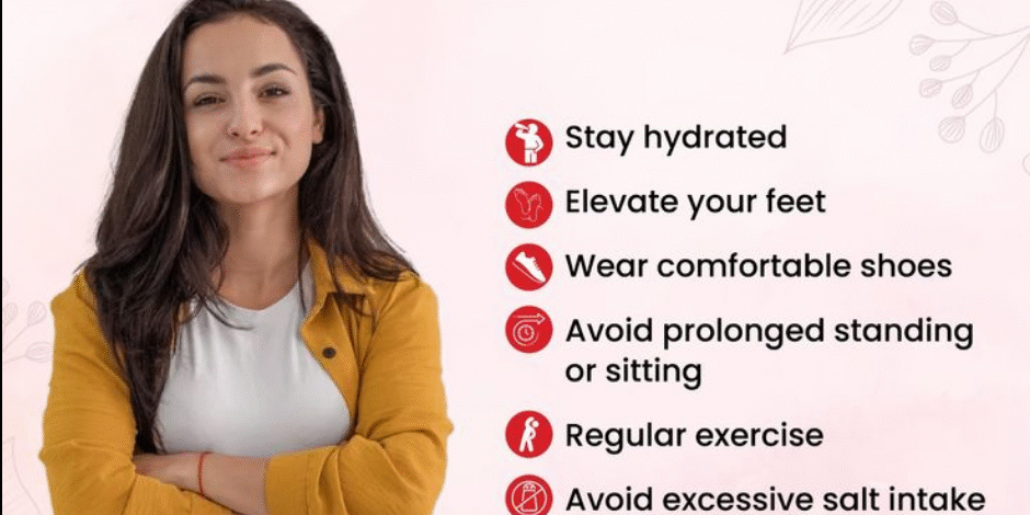 Swelling in Pregnancy