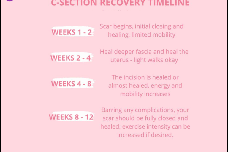 C-Section Recovery Timeline: Essential Guide for New Moms C-Section Recovery Timeline