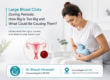Large Period Clots: When to Consult a Gynecologist in PCMC